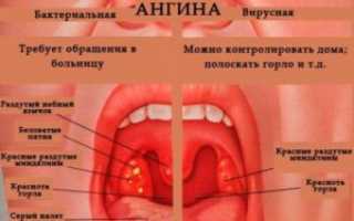 Что с горлом? Горло не болит температуры нет