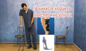 Как начать ходить после инсульта