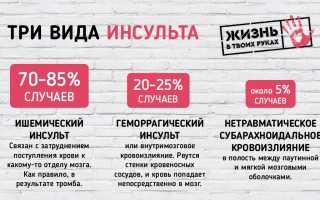 Симптомы всех видов инсульта