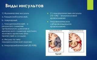 Диагностика любого вида инсульта и вспомогательные методы