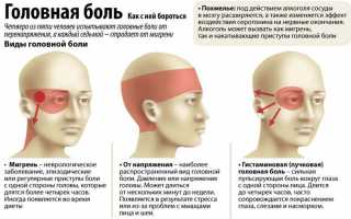 Лечение и симптомы абузусной головной боли