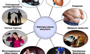Как предотвратить наступление инсульта головного мозга