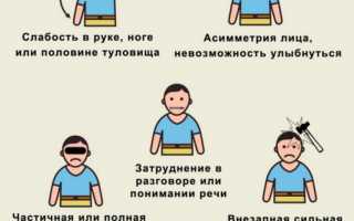 Определение инсульта по неврологическим симптомам