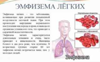 Эмфизема легких, хрип и бульканье в лежачем положении