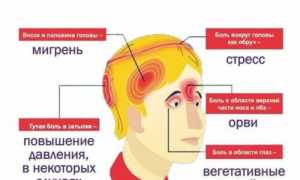 Пульсирующая боль с левой части головы