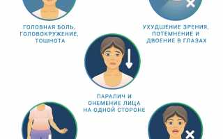 Диагностика и симптомы транзиторной ишемической атаки
