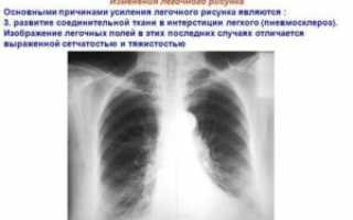 Долго кашель и усиление легочного рисунка