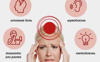 Причины и лечение головной боли при остеохондрозе шейного отдела