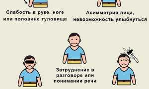 Какие возникают последствия после инсульта