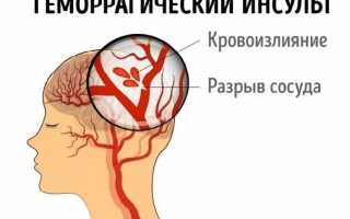 Когда возникает геморроидальный или геморрагический инсульт