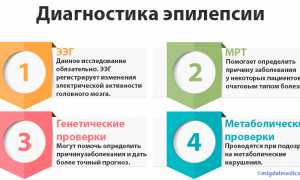 Симптомы и диагностика определяющие абдоминальную эпилепсию