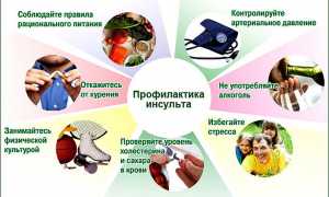 Симптомы и лечение детского инсульта