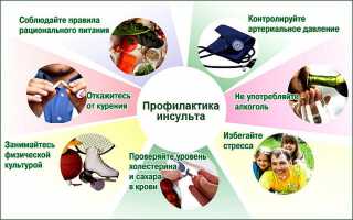 Симптомы и лечение детского инсульта