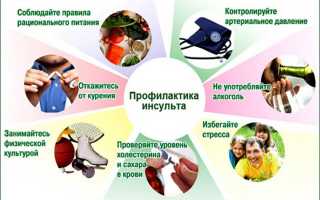 Как предотвратить повторный инсульт