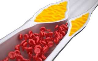 Продукты, которые очищают сосуды от холестерина