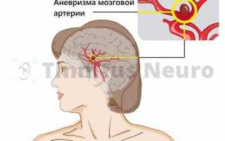 Может ли от уха болеть голова?