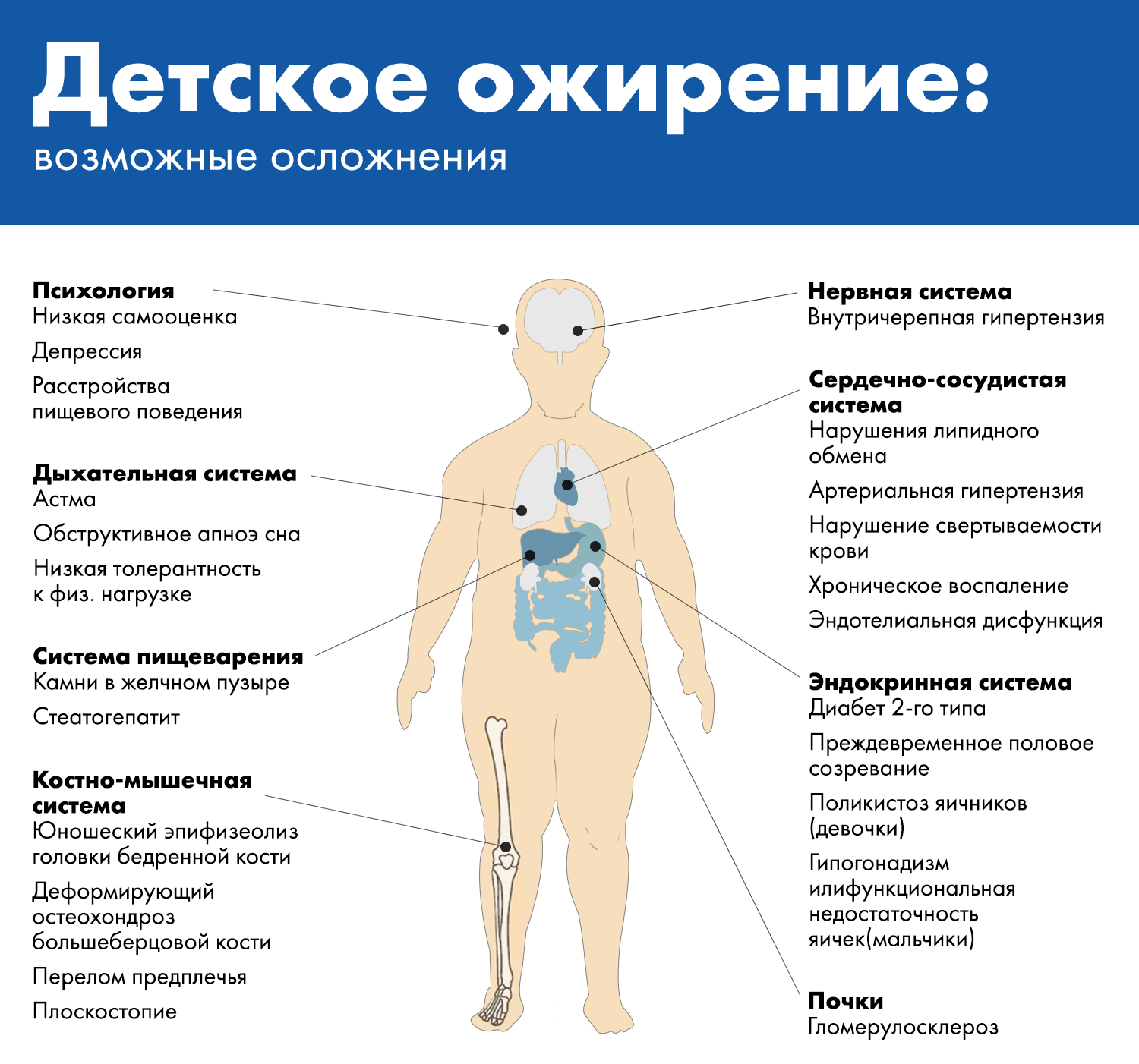Детское ожирение - последствия 